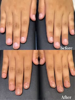 深爪矯正＋ワンカラー ホームケアオイル付き