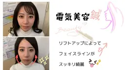 ❤️美容鍼1500円クーポン❤️ 【1週間前に事前ご予約の方限定】