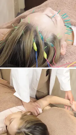 【お顔と体のお悩みに※口コミ必須】【小顔整顔美容鍼】鍼+電気パルス+整顔調整＋整体　120分