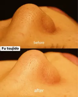 【フェイシャルワックス】通常¥7700→