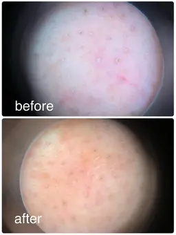 フェイシャル首肩ケアコース