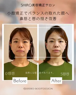 【40​〜​60代症例モニター】たるみ・フェイスライン改善🌿勝山式立体小顔矯正70分