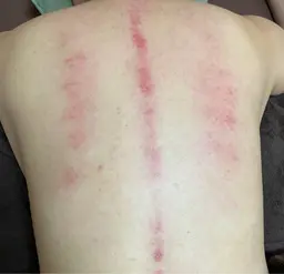 ☆ミニモ価格☆【かっさ背中ケア70分】かっさ背中+頭蓋骨矯正(ヘッド)+整顔+首肩オイルリンパ