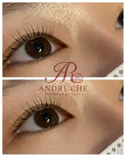 シンプリフィラッシュリフト