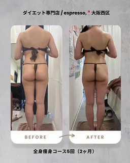 1番痩せる人気no.2🤍【全身痩身120分】フル体験クーポン✨💆🏻‍♀️4種の痩身が試せる！ガッツリ痩せたい方🔥