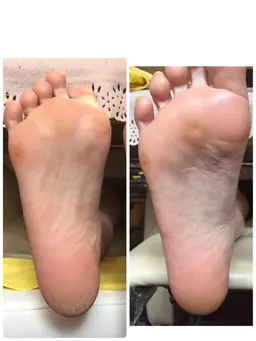 ★新規様★ドイツ式フットケア