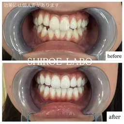 ミニモ限定価格‼️30分照射¥2,980