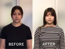 【当店独自矯正】むくまない小顔に！小顔矯正＋リンパフェイシャル￥3980円! !