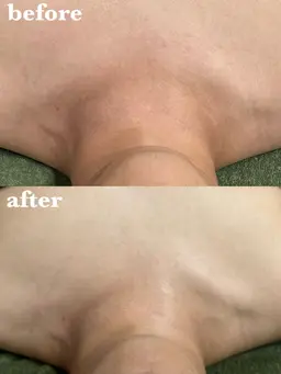 【肌ケア・痩身】陶肌トリートメント｢お顔｣+｢デコルテ｣(陶肌パウダー1ｇプレゼント価格)