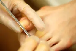 ◆足の爪ケア◆【分厚い、でこぼこ、食い込み、変形など】　トラブル低​〜​中程度