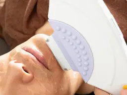 男性髭のみ脱毛🥸✨