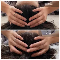 ドライヘッドマッサージ