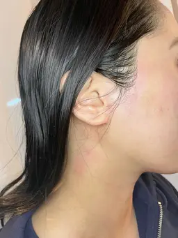 《初回》頸(うなじ)×もみあげワックス脱毛　4500円