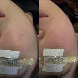 ⭐︎人気No.1⭐︎《眉毛&まつ毛&お顔脱毛》 スペシャルセット