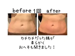 腸の悩みを解決！癒し腸もみ70分♪こだわりの水素オイルを✨贅沢✨使用♪ 足ツボorヘッドマッサージで腸リラックスへ♪