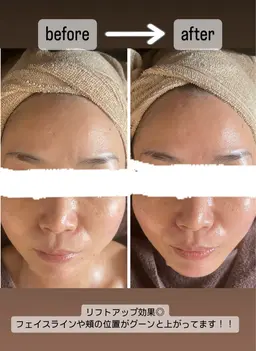 小顔フェイシャル＆デコルテトリートメント60分(快眠ドライヘッド込み)