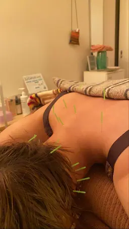 全身矯正(鍼&マッサージ)