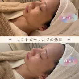 短時間で透明感UP✨毛穴スッキリ時短エステ
