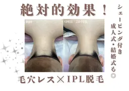 👘新成人限定👘うなじIPL（熱破壊式）脱毛‼︎安心のシェービング付き✨完璧な晴れ姿✨