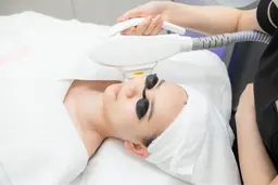 【☆感動の白さ＆ニキビケア＆毛穴＆赤み】光フェイシャルコース90分¥13000