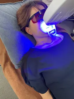 🦷セルフホワイトニング🦷¥4,980→¥2,980期間限定10名様