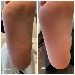 秋冬でかさついたかかとをツルツルに🦶マシーンでしっかり角質除去で赤ちゃんかかと✨