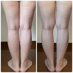 クベルジェルトリートメント「minimo特別価格」