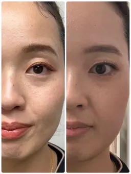 老け顔一気に脱出コース！！