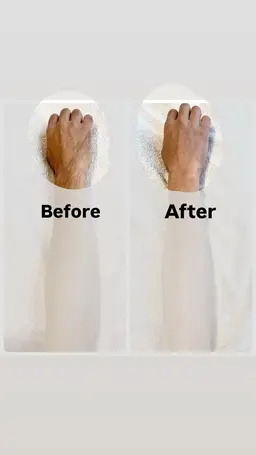 【minimo限定】選べるミニパーツ⭐︎シュガーリング脱毛【胸周りorへそ周りor手の甲&指】