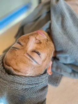 肌荒れの本気ケア！たまご肌に生まれ変わるハーブピーリング【ダウンタイム有】