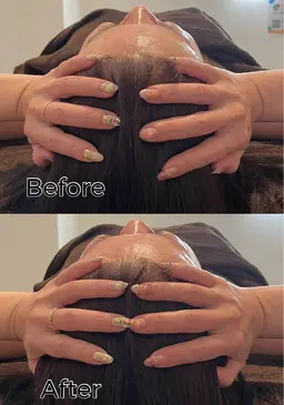 【究極の小顔コース‼︎】頭蓋骨矯正付きコース