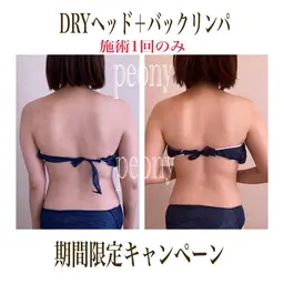 [極上の癒し]🌿超絶睡眠ヘッドスパ＋首肩凝りバックリンパ🌿