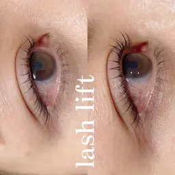 ラッシュリフト(ﾄﾘｰﾄﾒﾝﾄ付き)