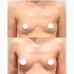 【本気の育乳‼️全身お試し】一回でふわふわ感動バスト✨️㊙️バストアップ法伝授！