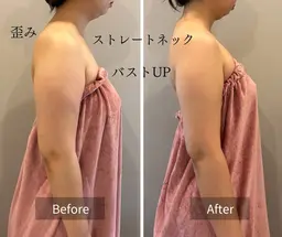 【産後ケア専用】下垂・ハリ低下に◎根本から整える本格バスト施術