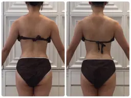 【上半身痩せ👙】キャビ＋ラジオ波＋マッサージ60分✨で気になる脂肪撃退✨