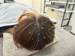 【💭寝ても疲れが取れない方へ💭】ひつじがいらない頭皮鍼 ¥8800→6600