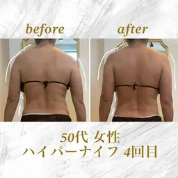 ハイパーナイフ 上半身or下半身