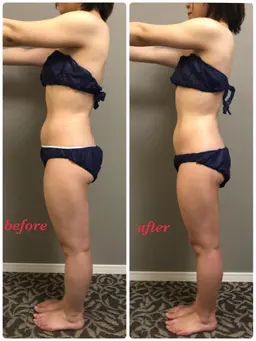 メリハリボディをつくるなら全身筋膜リリース👯‍♀️根本から改善しダイエットしやすい身体へ✨身体もスッキリ軽くなります✨