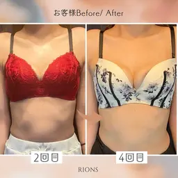 バストケア+美姿勢整体×ゆるほぐオイルエステ