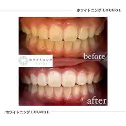 通常初回4980円のところ4回来店【10000円✨】