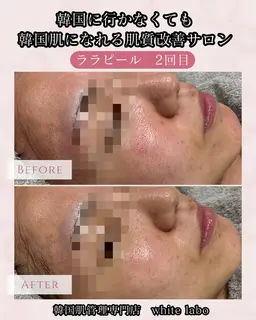 【SNSで超話題】憧れの韓国肌に💎水光肌艶ララピール