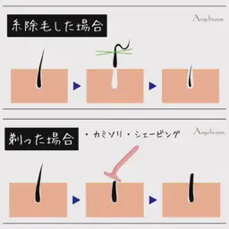 感動レベル🎉【お肌つるつる糸で顔脱毛* エイジングケアコース】うぶ毛✨ひげ✨ボサボサ眉毛✨化粧ノリアップ‼️