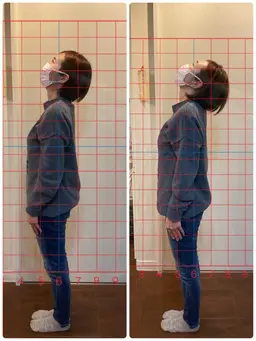 カイロプラクティック体験施術