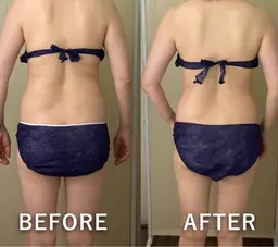 痩身◆【背中/二の腕コース】キャビ＋ラジオ派＋痩身マッサージ 55分 5500円→