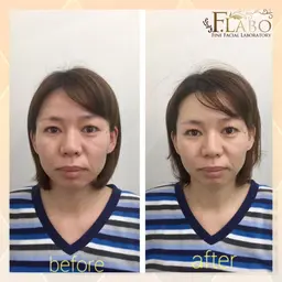 【くすみ・シミにお悩みの方】本気の肌改善(90分)