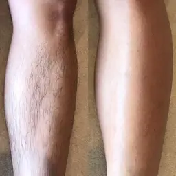 メンズWax脱毛初回★すね毛★