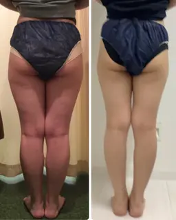 【🍬ほっそり実感🍬】セルライトつぶし➕肉トレ(EMS)🍖70分