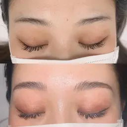 ハリウッドブロウリフト