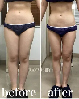 ⚔全身痩身⚔徹底サイズダウン！！スパルタ痩身50分￥2980